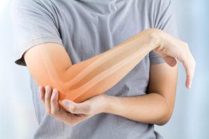 Tucson Bone Fractures and Breaks Lawyer